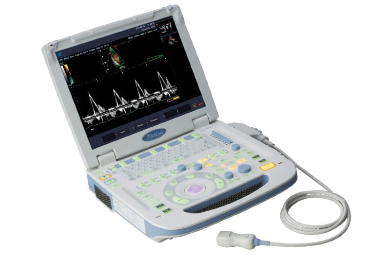 Portable ultrasound scanner