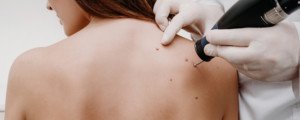 Discover the Most Advanced Technology with Digital Dermatoscopes